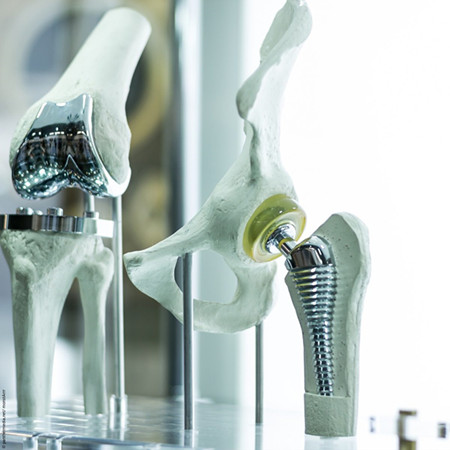 Orthopedic implants