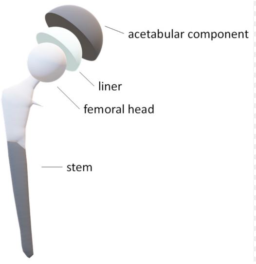ceramic femoral head